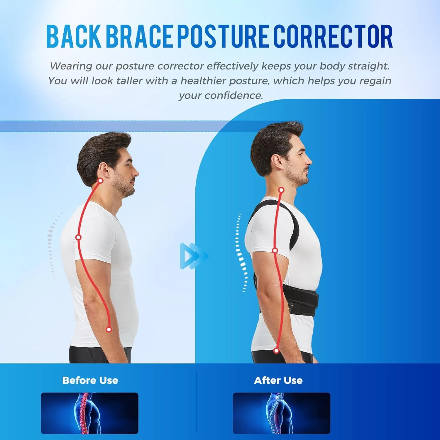 YOII Back Brace Posture Corrector for Men and Women, Fully Upper Back Support for Back,Neck,Shoulder,Lower Back Pain Relief